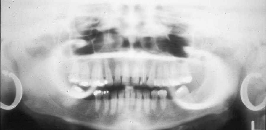 Dental Charting Practice Quiz